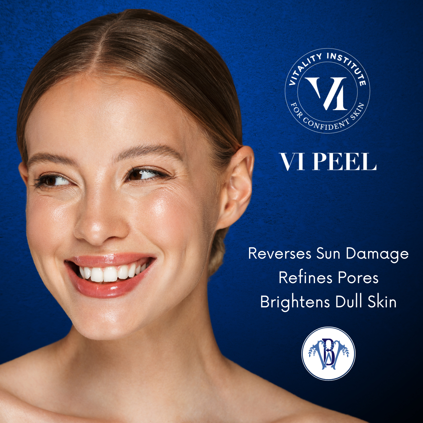 vi peel